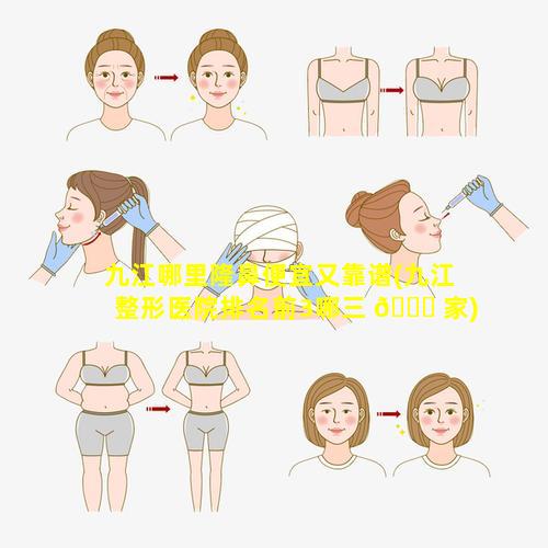 九江哪里隆鼻便宜又靠谱(九江整形医院排名前3哪三 💐 家)